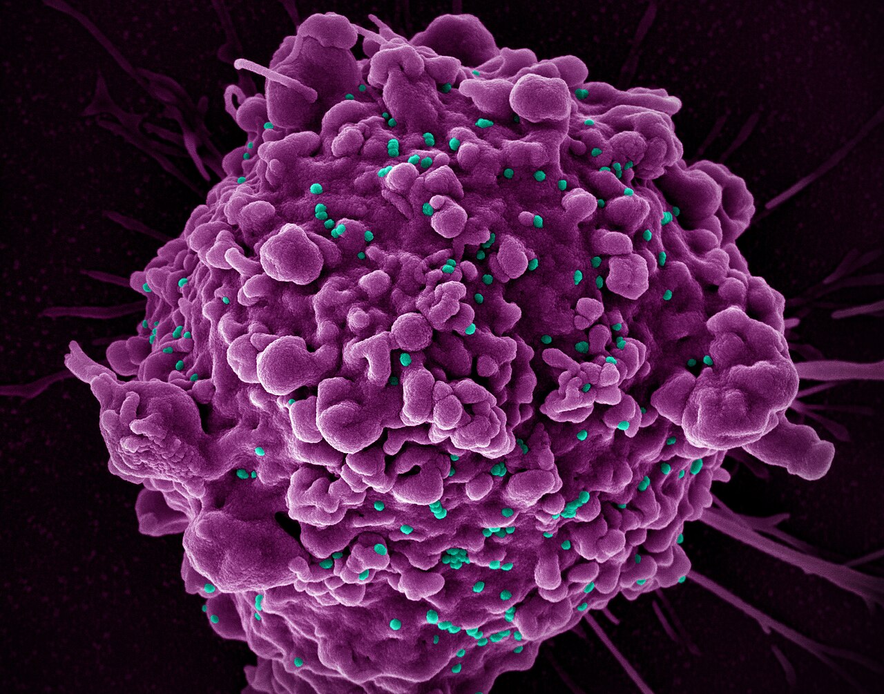 New HIV vaccine shows unprecedented success in preclinical study 图片 1