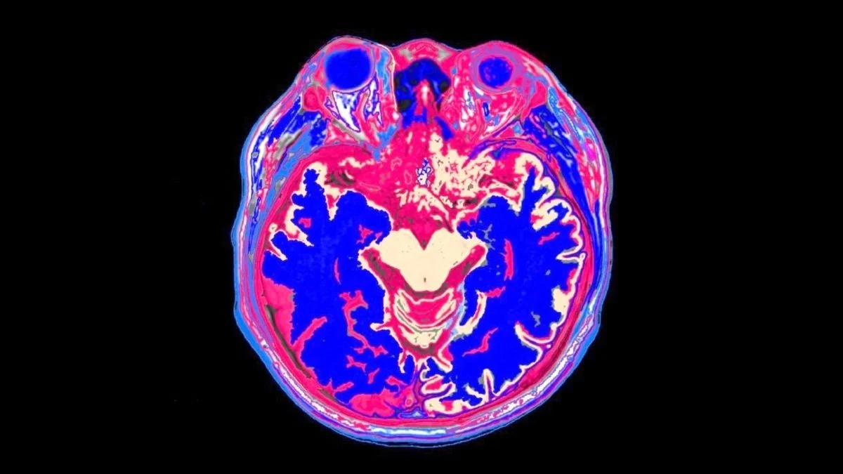 Bad News For Bingers: Watching Too Much TV Linked to Smaller Brain Volume 图片 1