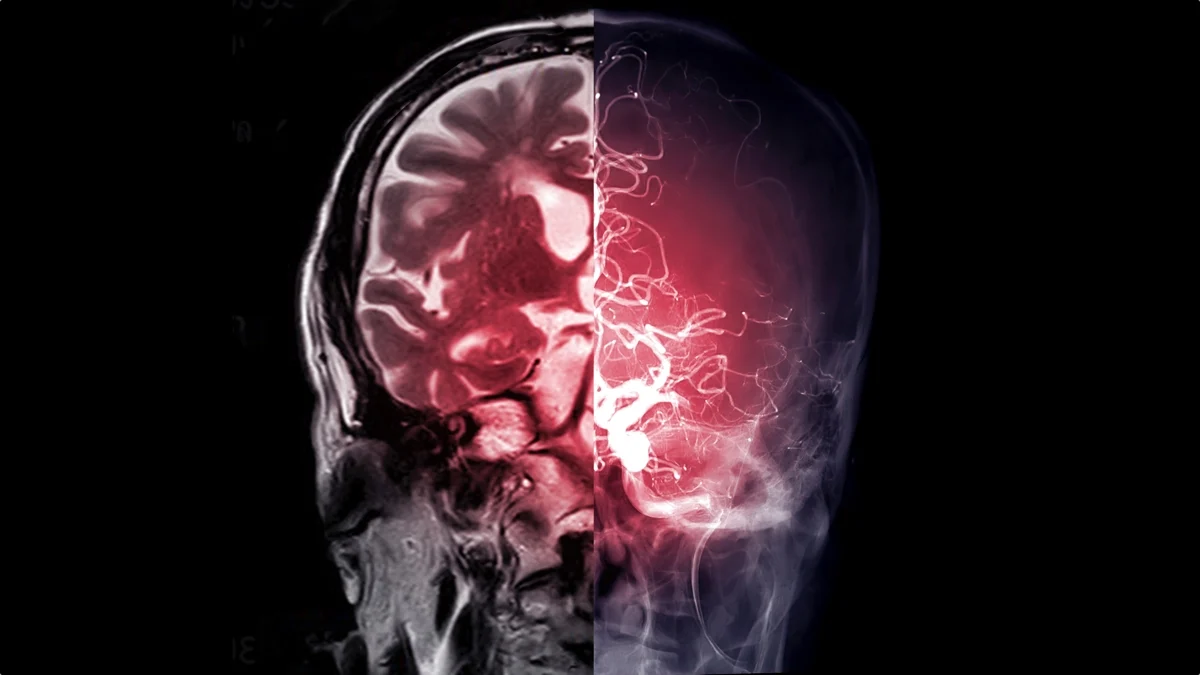 Diabetes Drug Used For More Than 60 Years Found to Unexpectedly Affect The Brain 图片 1