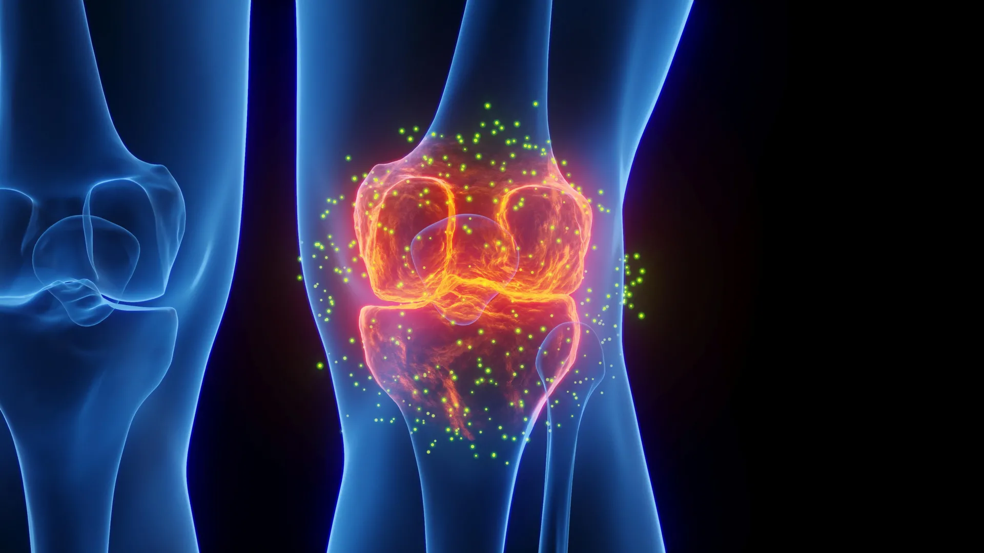 Stanford Scientists Regrow Lost Cartilage and Reverse Arthritis 图片 1