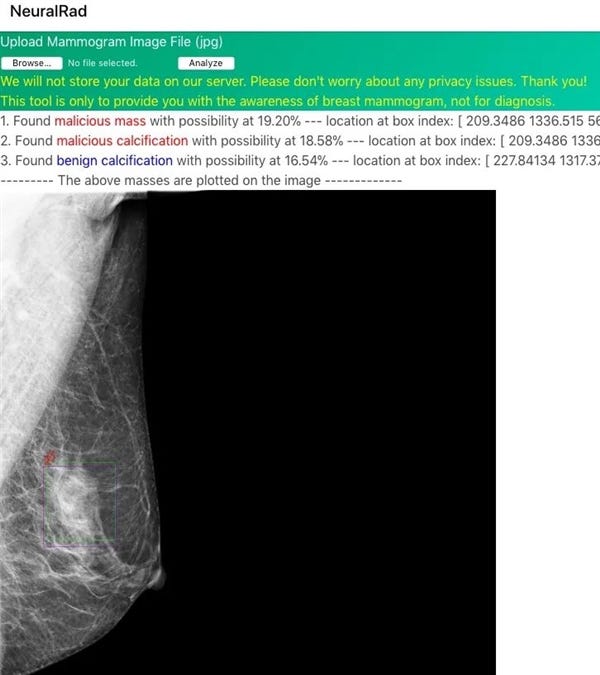 This "amateur" programmer fought cancer with 50 Nvidia Geforce 1080Ti 图片 1