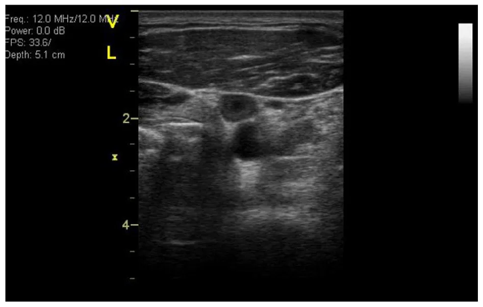 Establishing a VTE Risk Score for Astronauts Algorithm 图片 1