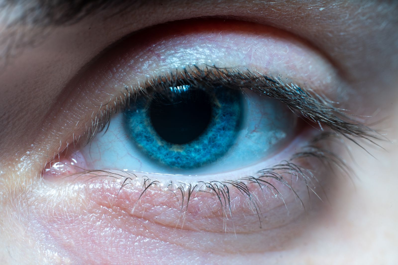 Everyone with ordinary inherited blue eyes appears to share a common ancestor, probably someone who lived around 6,000 to 10,000 years ago, when a tiny genetic switch near the OCA2 gene reduced bro... 图片 1