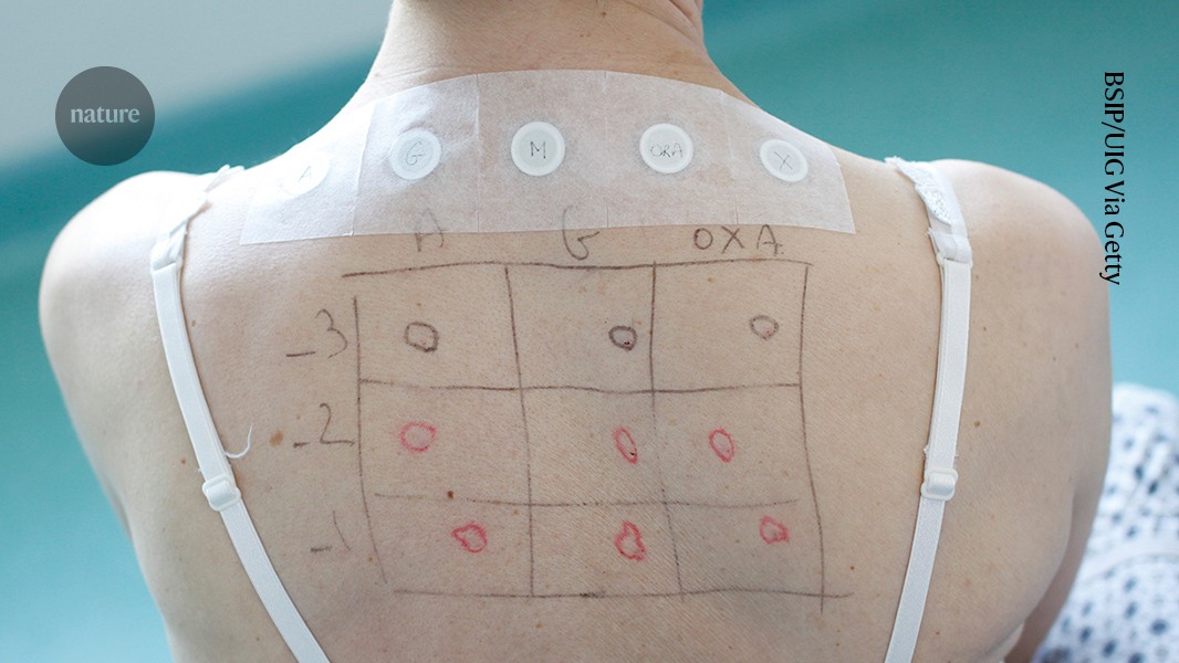 First poo transplant to treat food allergy in people has results 图片 1