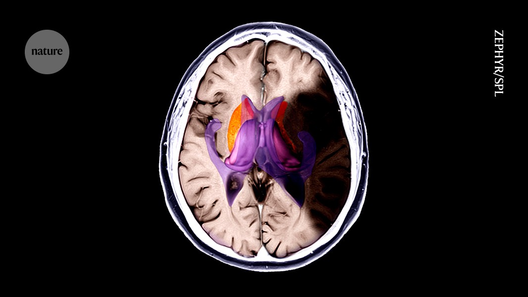 Freezing brain damage in its tracks: cooling drugs limit stroke injury in mice 图片 1