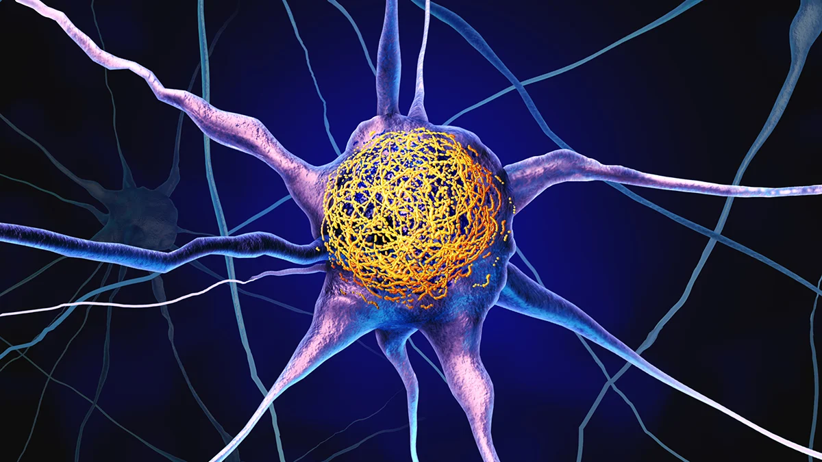 One Common Vitamin Could Lower Toxic Alzheimer's Proteins, Research Suggests 图片 2