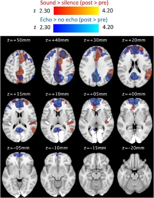 Humans Can Learn to Echolocate in Just 10 Weeks, And It Rewires The Brain 图片 2